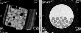 Figure 3: Alginate microparticles containing Au nanoparticles: proton density weighted scan (left), T2 weighted scan (right).