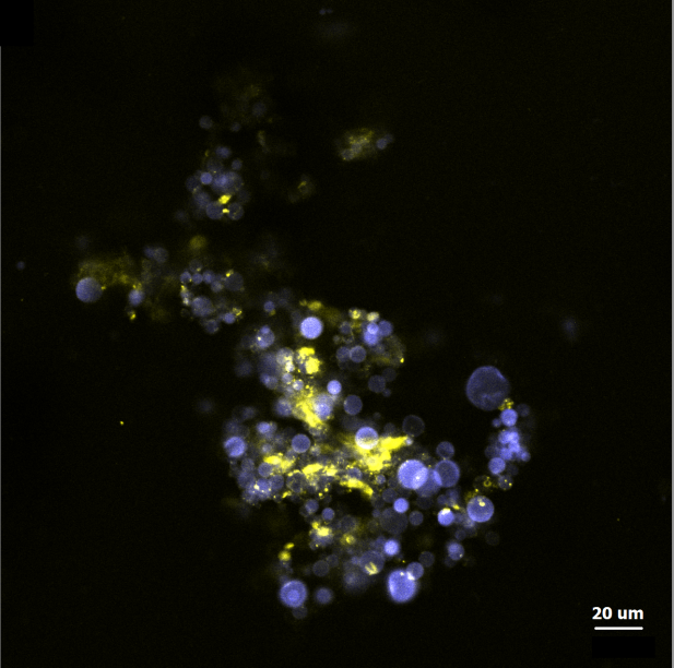 Laser scanning confocal microscopy image of aggregates composed of chitosan (blue) and alginate (yellow) particles at mass ratio 1:1